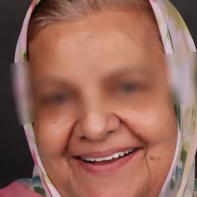5 روش رعایت مراقبت از دندان سالمندان