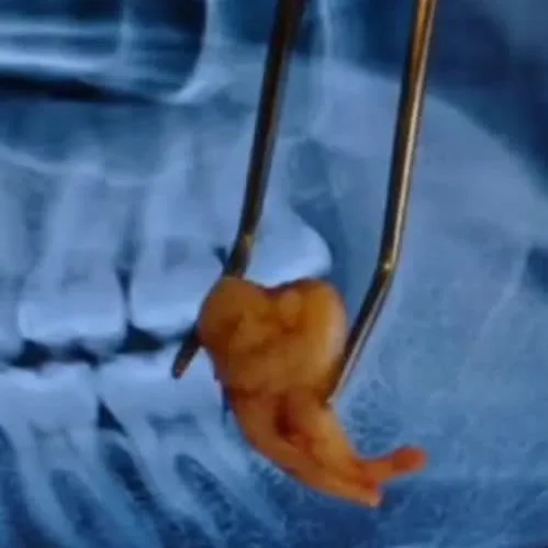 10 نکته برای افرادی که دندان های حساس دارند(10 tips for people with sensitive teeth)