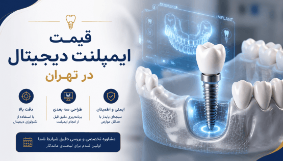 قیمت ایمپلنت دیجیتال