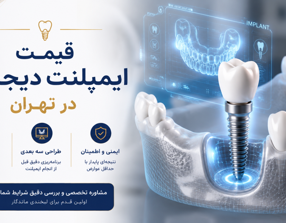 قیمت ایمپلنت دیجیتال