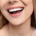 10 عوارض کامپوزیت دندان [راه‌های مراقبت و پیشگیری]