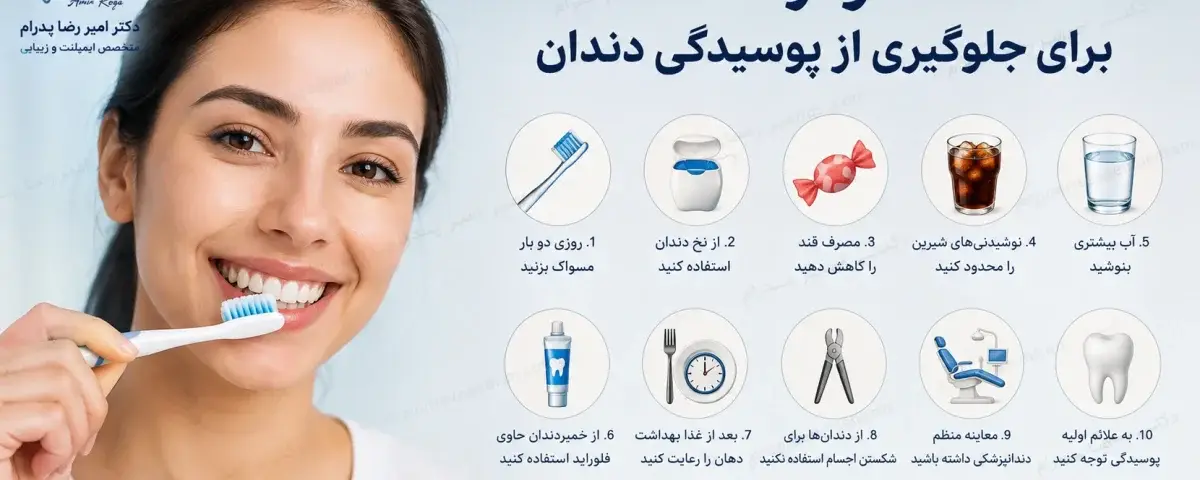 10 نکته جلوگیری از پوسیدگی دندان