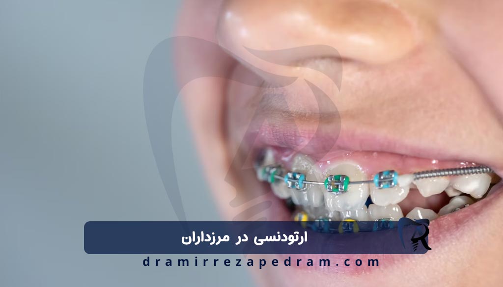 ارتودنسی در مرزداران
