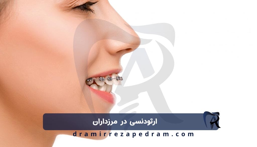 ارتودنسی در مرزداران