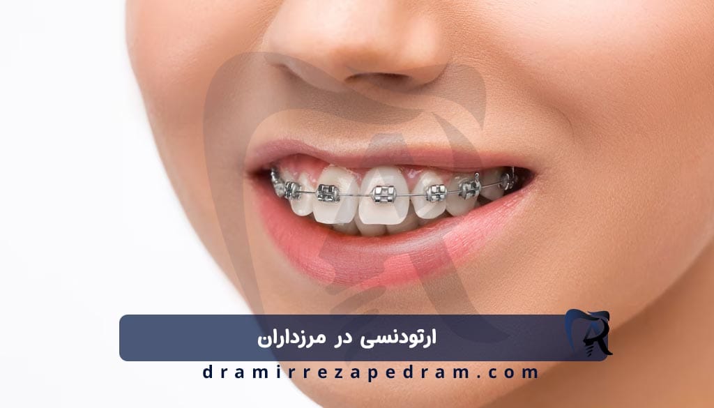 ارتودنسی در مرزداران
