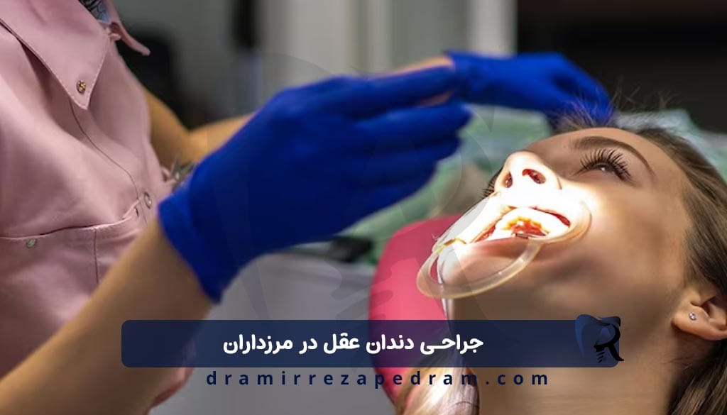 جراحی دندان عقل