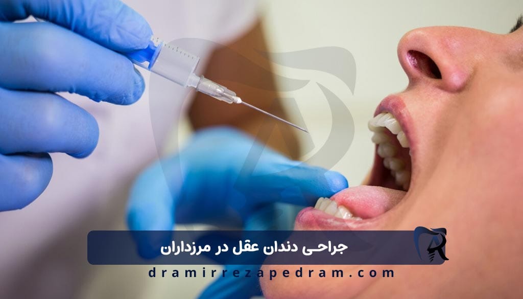 جراحی دندان عقل