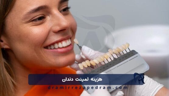 قیمت لمینت دندان در تهران