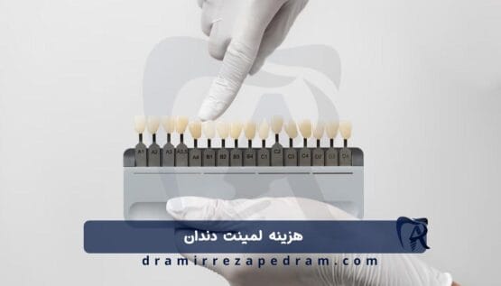 هزینه لمینت دندان