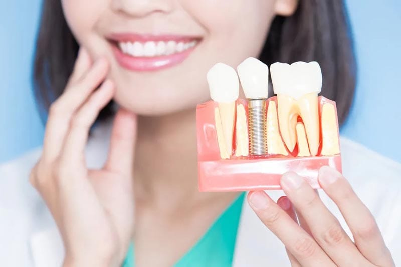 مراقبت های بعد از انجام ایمپلنت دندان