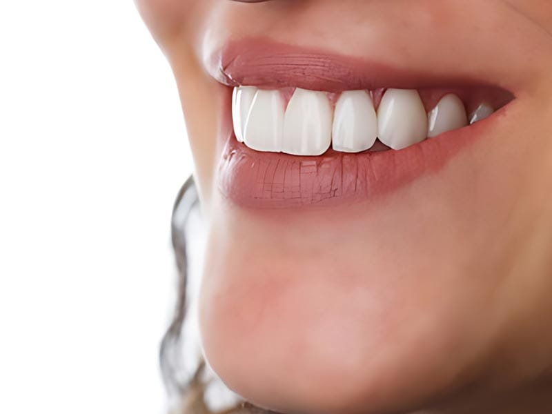 مزایا و معایب لمینت چیست؟