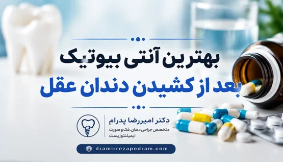 بهترین آنتی بیوتیک بعد از کشیدن دندان عقل
