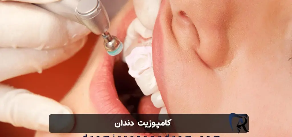 کامپوزیت دندان در ستارخان تهران