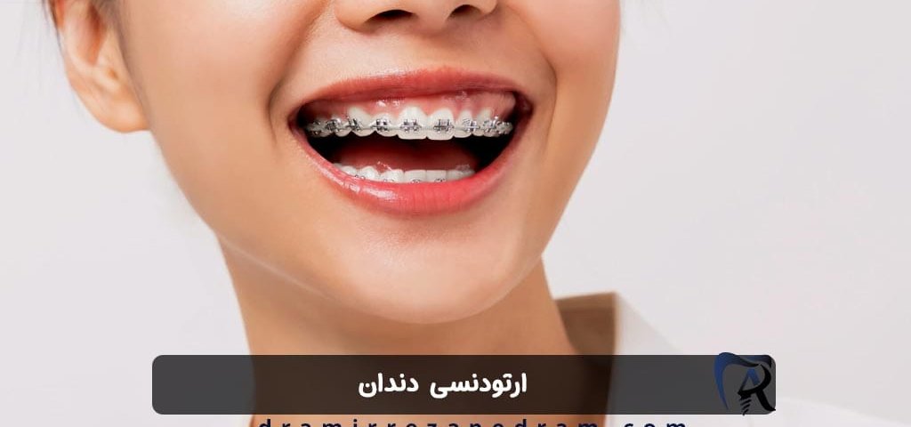 ارتودنسی دندان در ستارخان تهران