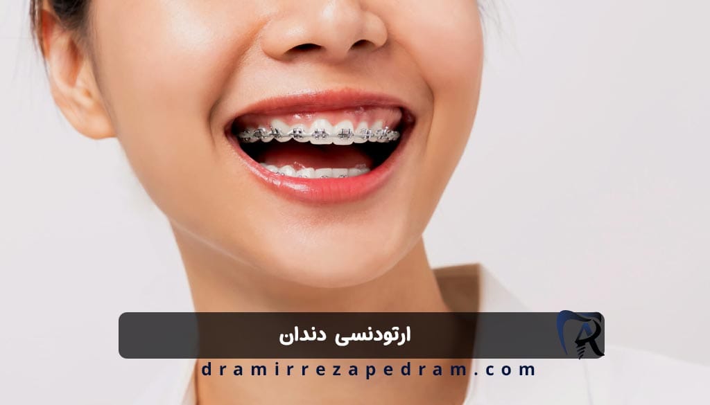 ارتودنسی دندان در ستارخان تهران