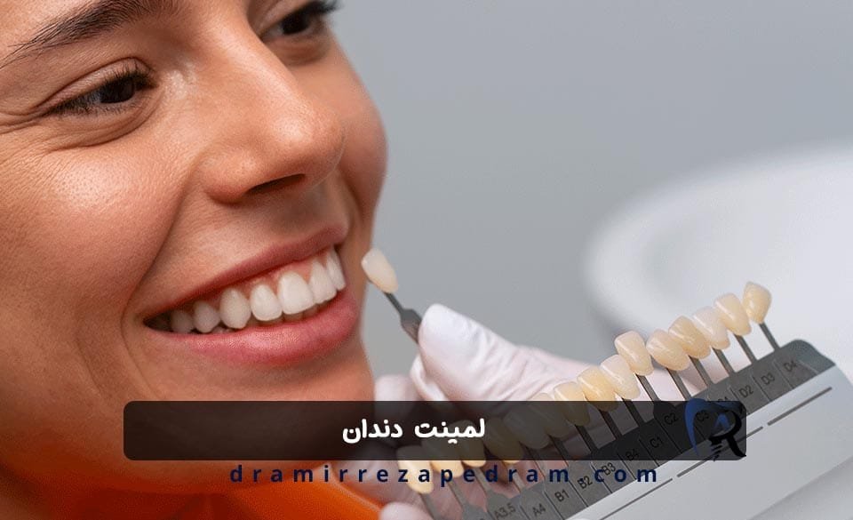 لمینت دندان در ستارخان تهران