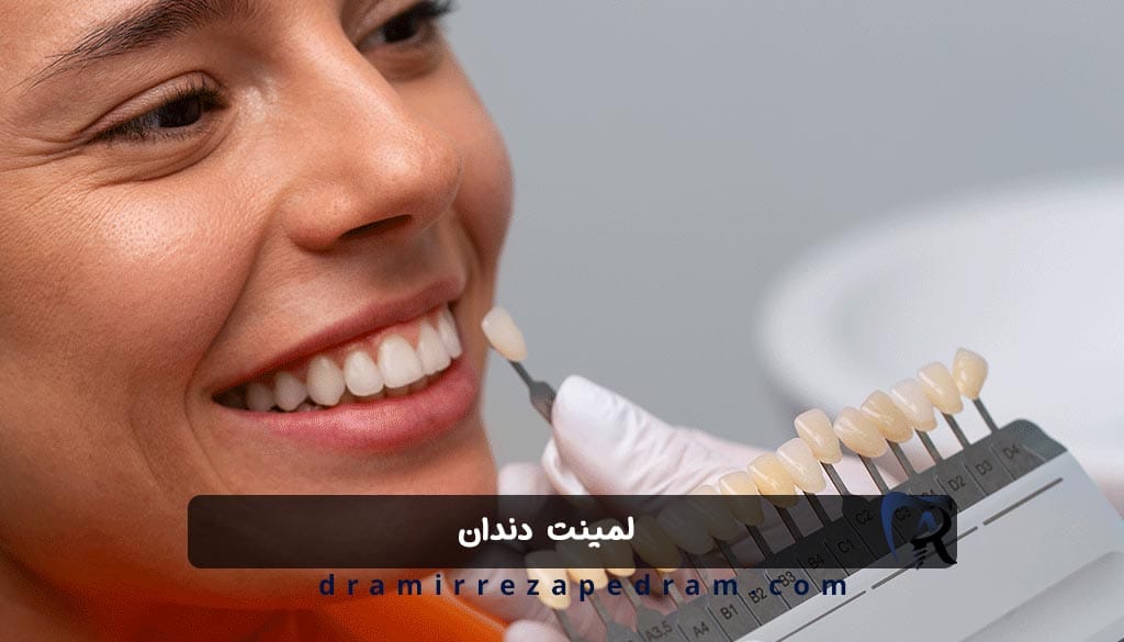 لمینت دندان در ستارخان تهران