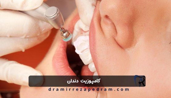 کامپوزیت دندان در ستارخان تهران