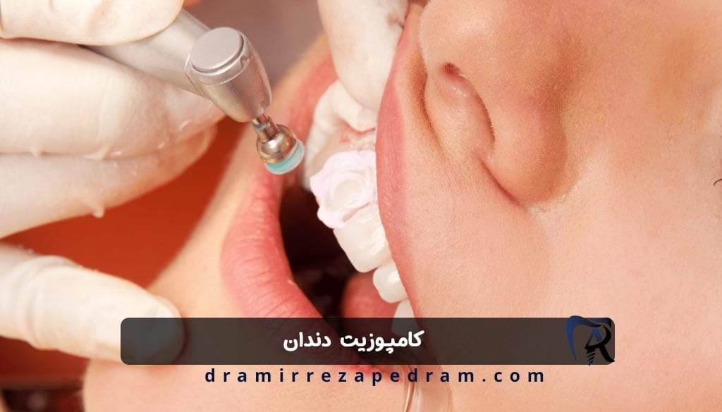 کامپوزیت دندان در ستارخان تهران