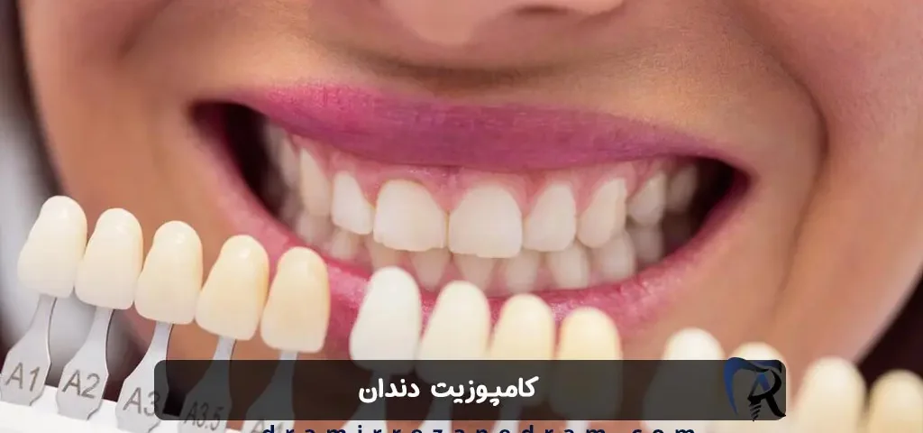 کامپوزیت دندان در مرزداران