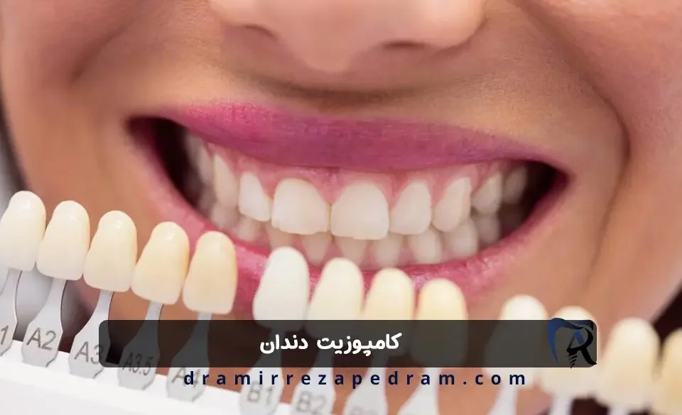 کامپوزیت دندان در مرزداران