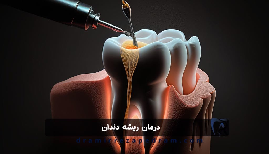 درمان ریشه دندان در ستارخان تهران