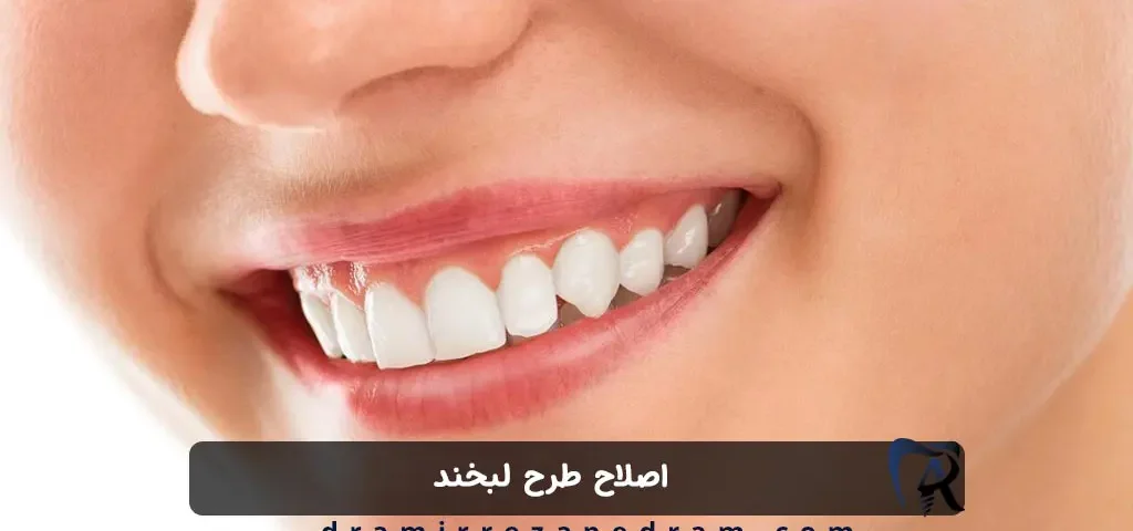 اصلاح طرح لبخند در مرزداران