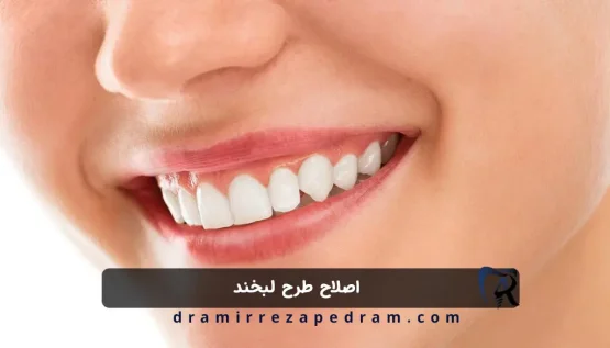 اصلاح طرح لبخند در مرزداران