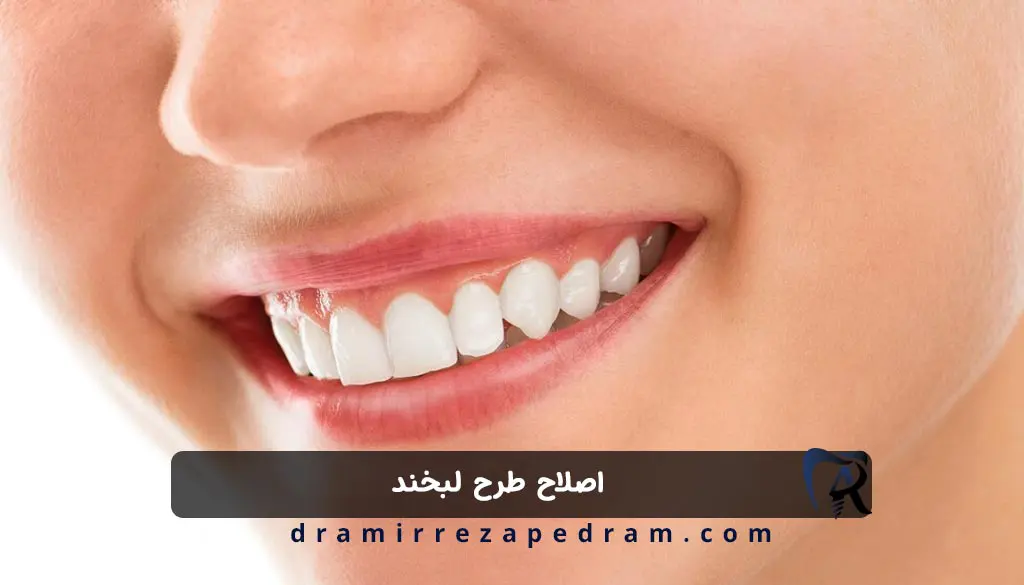 اصلاح طرح لبخند در مرزداران