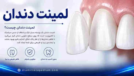لمینت دندان چیست؟