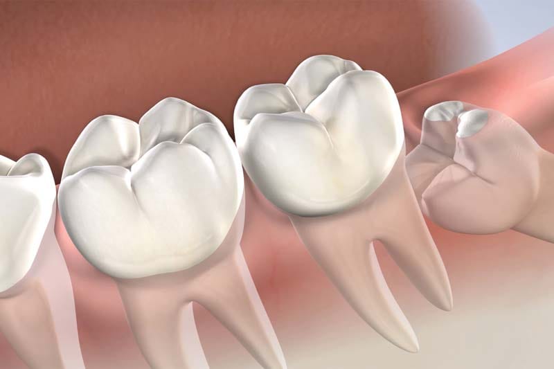 به چه نکاتی باید در مصرف آنتی بیوتیک ها توجه کنیم؟