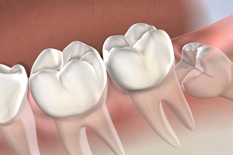 عوامل موثر بر مدت زمان درد دندان چیست؟