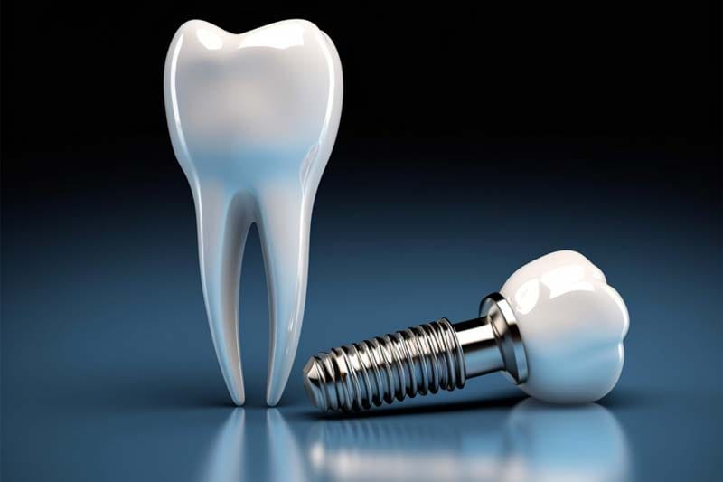 ایمپلنت نئودنت