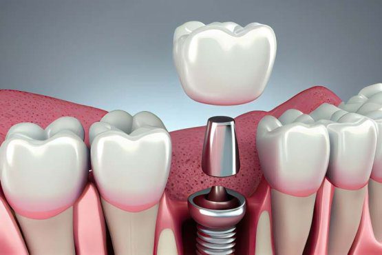 مزایا و معایب برند زایگما چیست؟