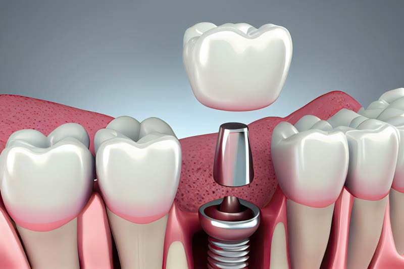 مزایا و معایب برند زایگما چیست؟