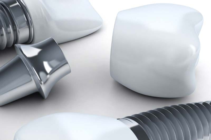 مراحل کاشت ایمپلنت اشترومن چیست؟