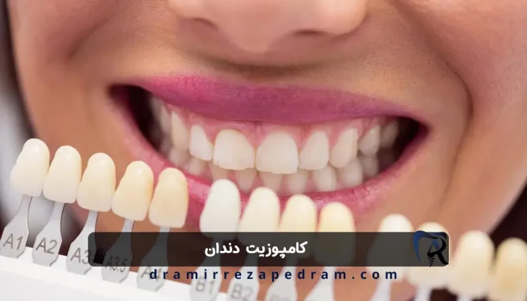 کامپوزیت دندان در مرزداران