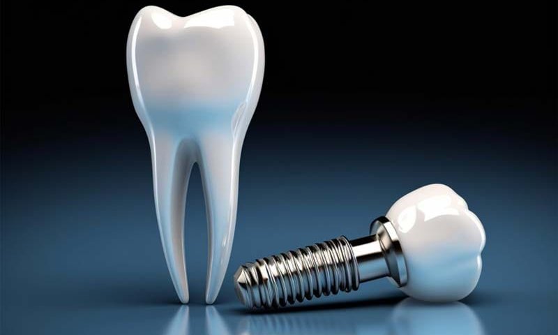 ایمپلنت کره ای آستم