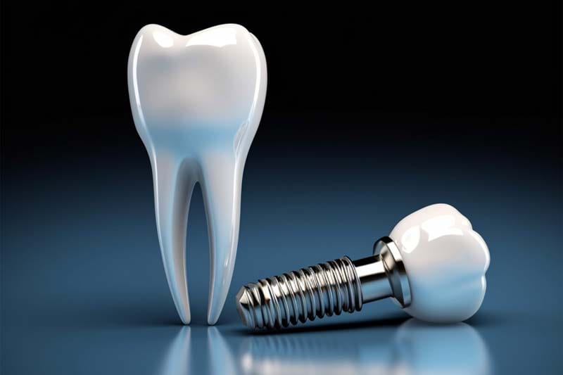 ایمپلنت کره ای آستم