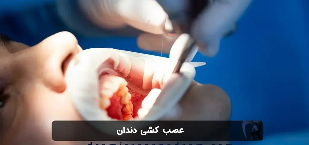 عصب کشی دندان در مرزداران