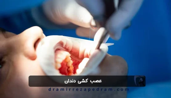 عصب کشی دندان در مرزداران