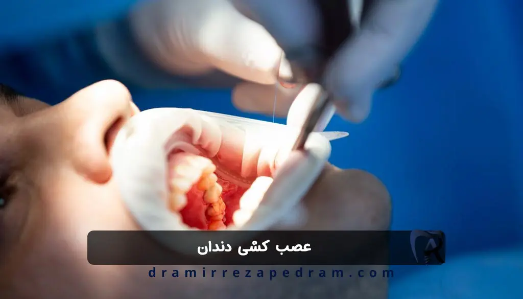 عصب کشی دندان در مرزداران