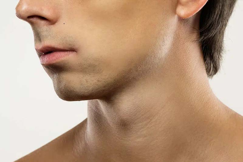 بعد از جراحی فک و صورت در غرب تهران به چه مراقبت هایی نیاز داریم؟