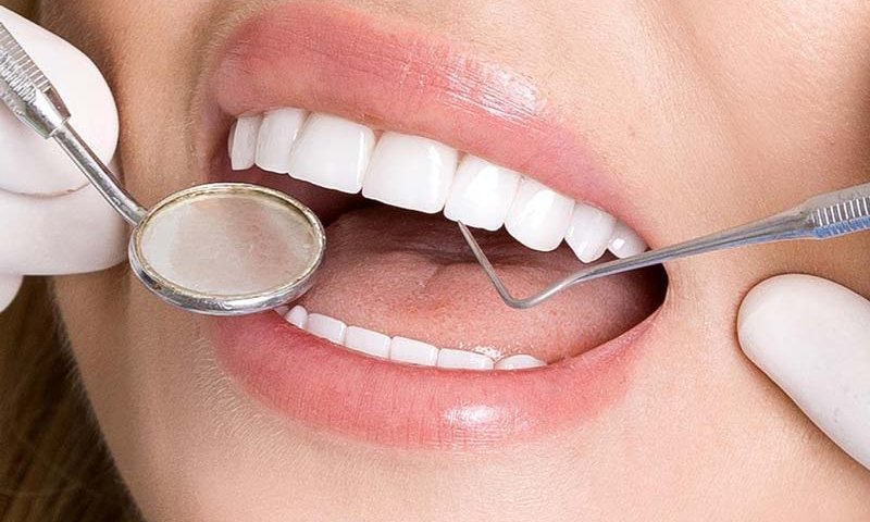 لمینت دندان در غرب تهران