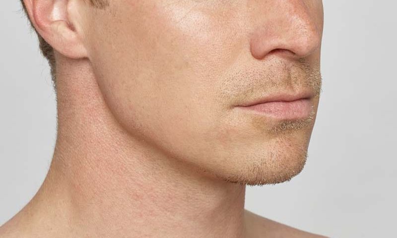 جراح فک و صورت در غرب تهران