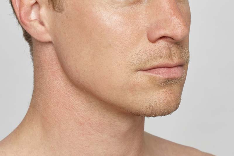 جراح فک و صورت در غرب تهران