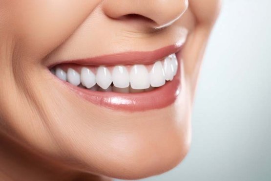 رعایت نکات و مراقبت های قبل و بعد از دندانپزشکی زیبایی در غرب تهران
