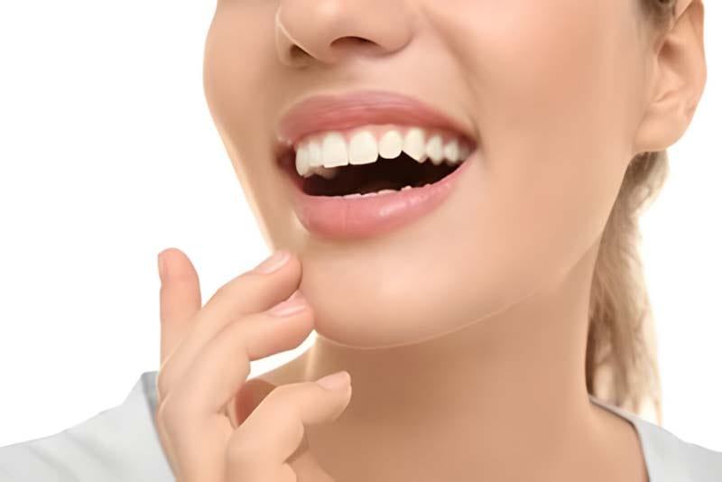 مراقبت های پس از اصلاح طرح لبخند