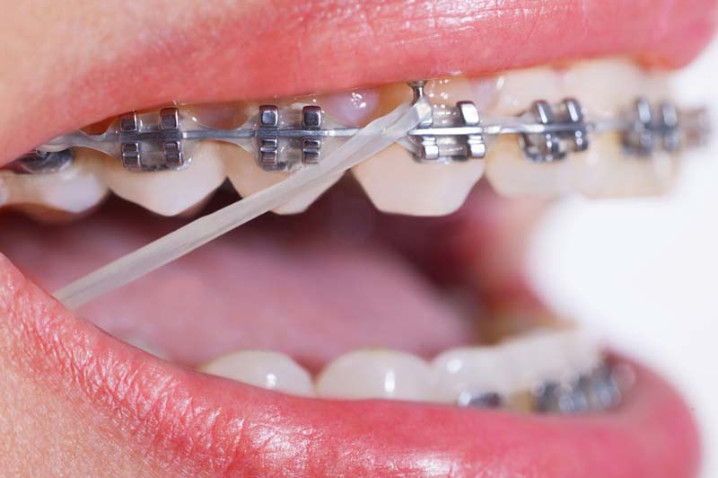 چرا انتخاب ارتودنسی دندان در صادقیه تهران؟