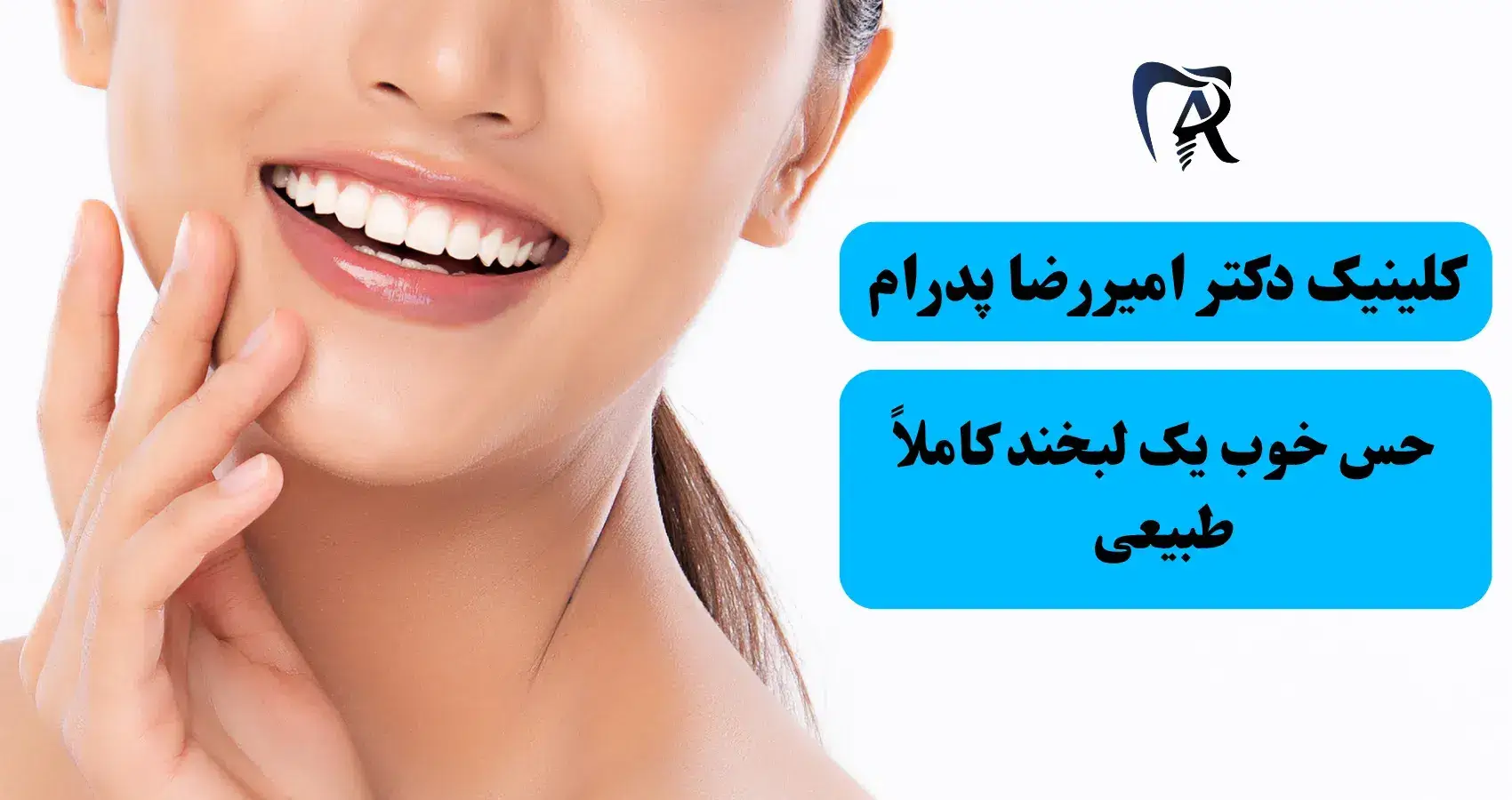 قبل و بعد لمینت دندان در صادقیه - کلینیک دکتر پدرام